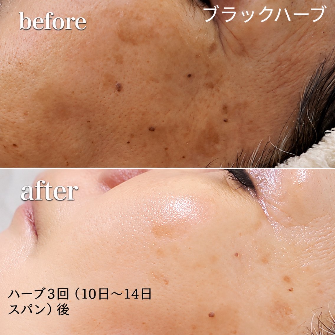 エステ リラク 美肌革命×本格痩身店 癒し隠れ家salonのエステ・リラクイメージ
