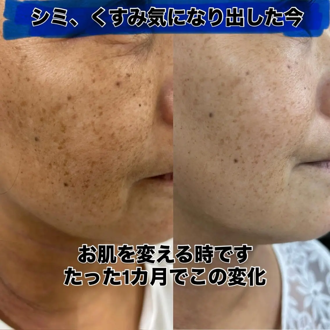 ナリス　デアイム西宮 辻　江梨那のエステ・リラクイメージ