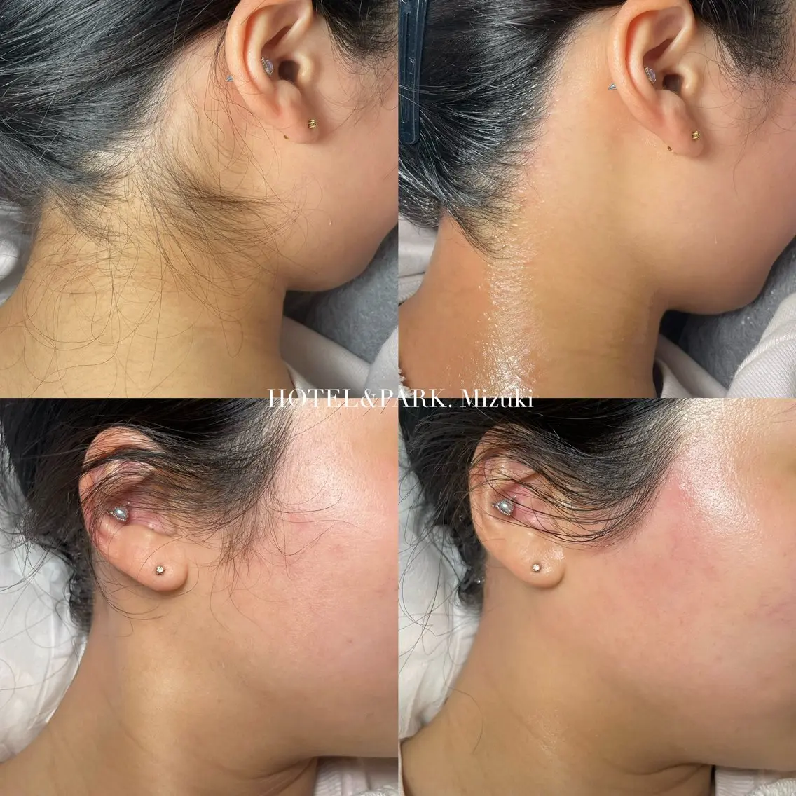 セミロング ヘアアレンジ 脱毛 HOTEL&PARK . ワックス脱毛のエステ・リラクイメージ