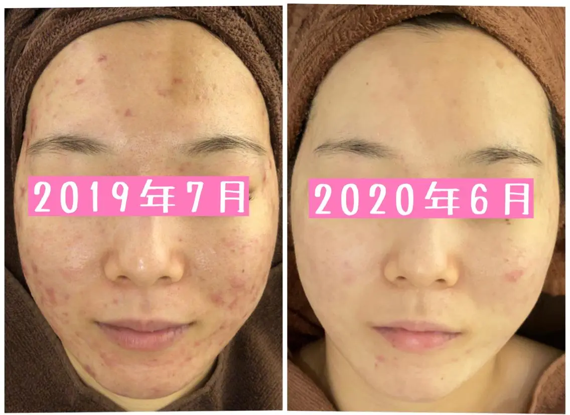 ミディアム カラー パーマ ヘアアレンジ メンズ キッズ ネイル マツエク・マツパ エステ リラク ニキビ・肌質改善専門 ♡人生が変わるサロンのエステ・リラクイメージ