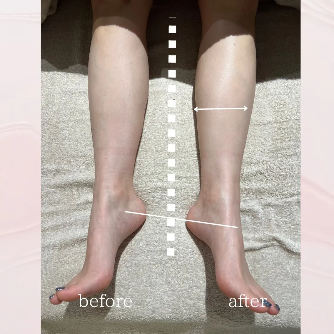 🤍むくみ取りにはこれ🤍魔法の足つぼ🦶🏻リフレクソロジー60min【むくみ/コリ/リラックス/足痩せ】の写真