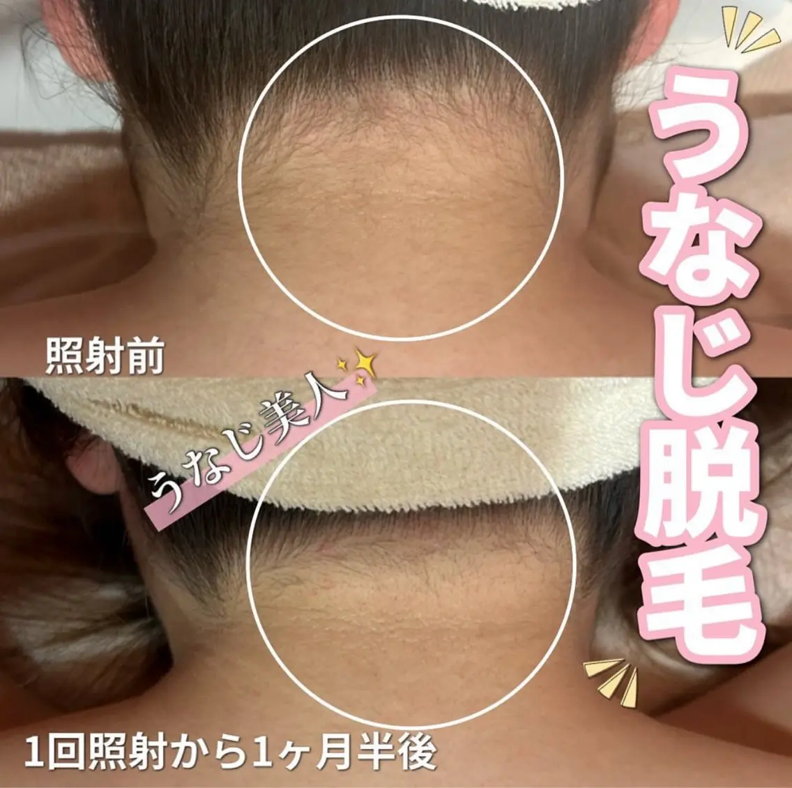 脱毛 SALON韓国肌管理 東別院のエステ・リラクイメージ