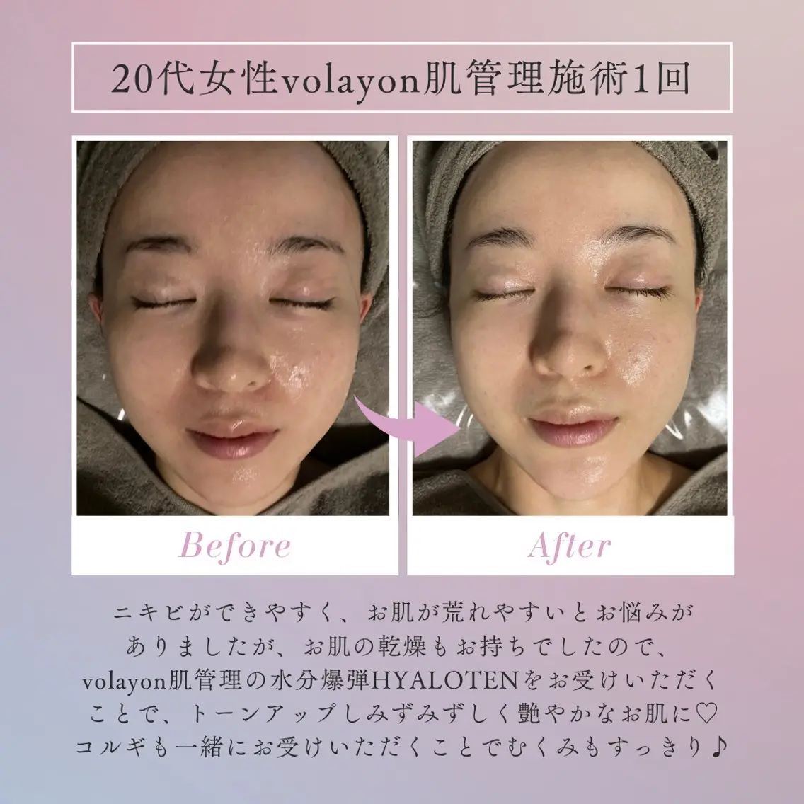 エステ MO MOのエステ・リラクイメージ