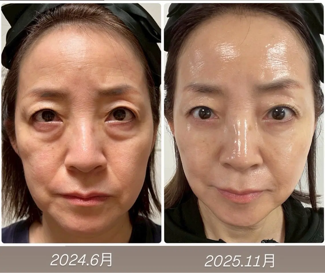 肌管理サロン vidyto MOEのエステ・リラクイメージ