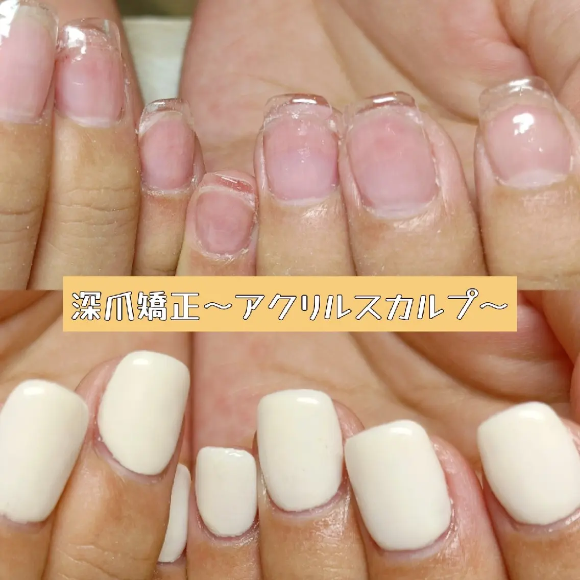 ネイル スカルプネイル ハンドネイル ハンドケア 深爪矯正/爪育成ケア manie nailのネイルデザイン