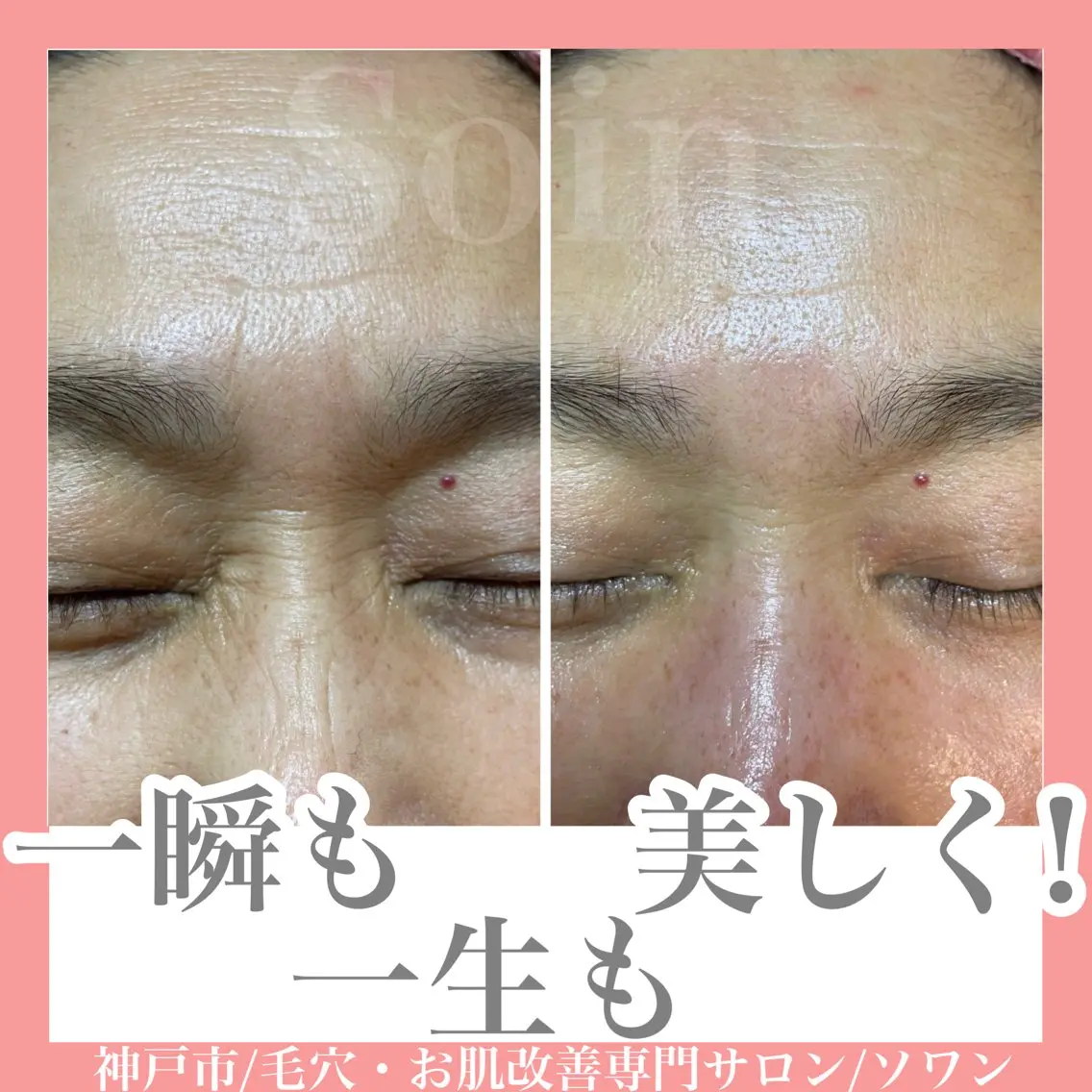 化粧崩れしないお肌土台作りコースの写真