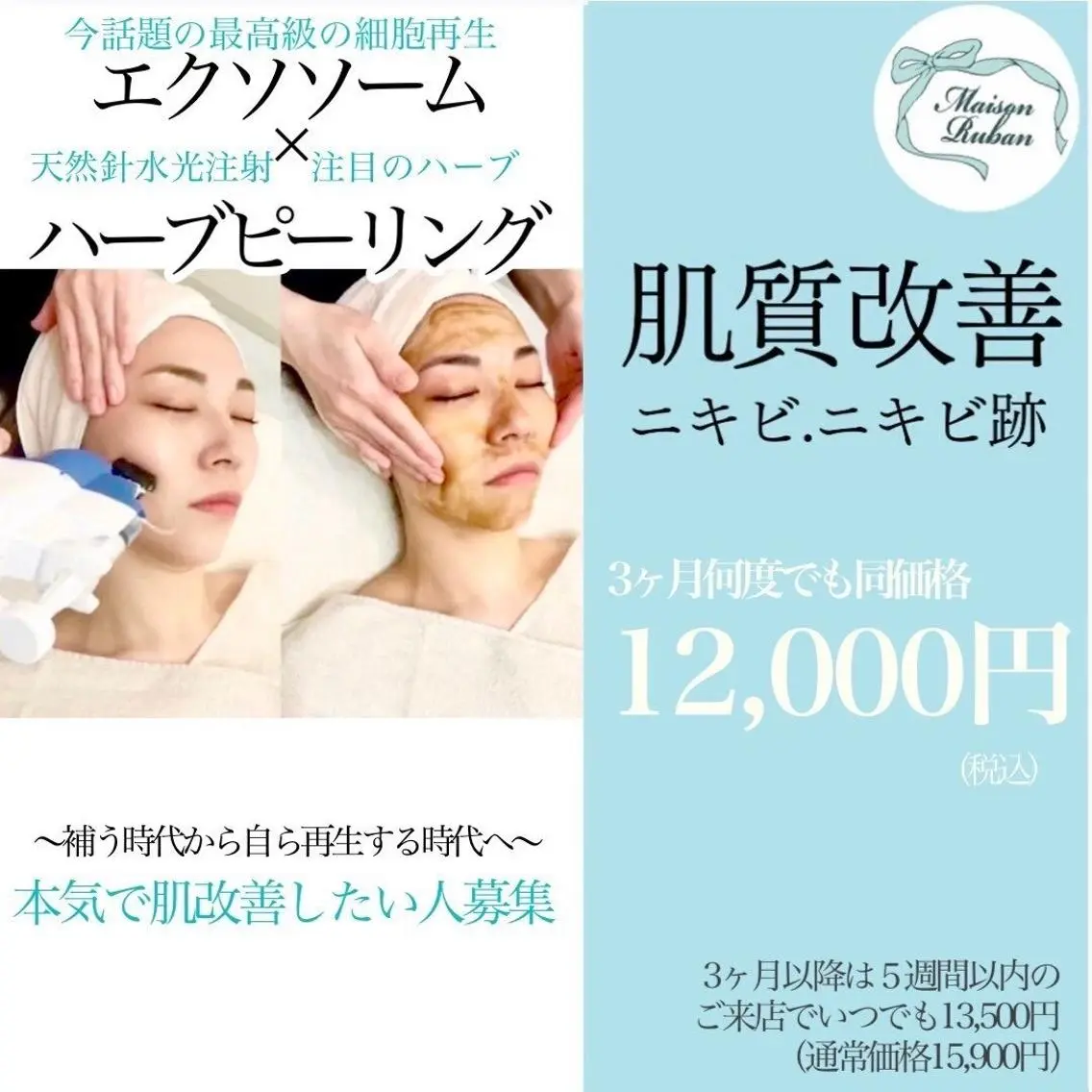 モニター10名限定価格💫【くり返す大人ニキビに⭐️徹底肌質変化】🧬エクソ導入×ハーブピーリング🌿の写真
