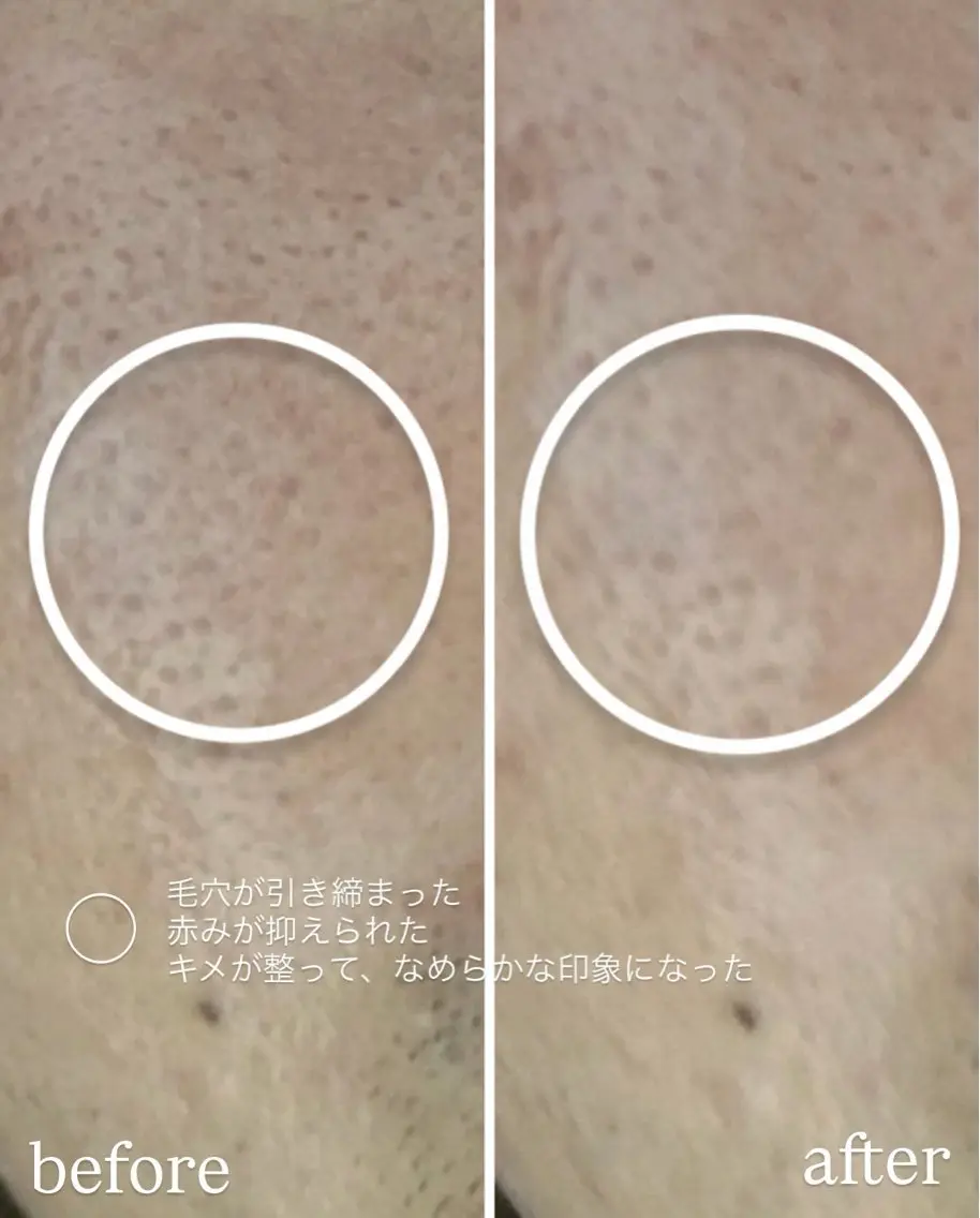 エステ デアイム もえかのエステ・リラクイメージ