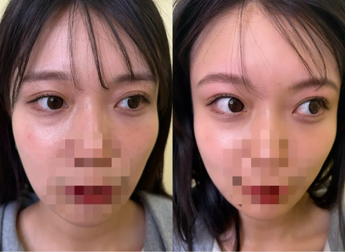 アイブロウ ワックス脱毛 その他(アイブロウ) 眉毛/美肌の専門店 Mily🍒ミウィの眉毛・アイブロウイメージ