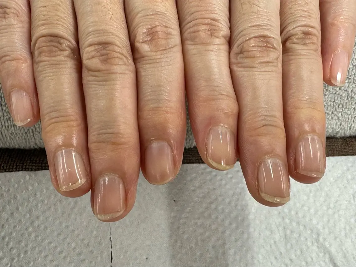 ハンド ネイルケア モデル 【美爪育成】の写真