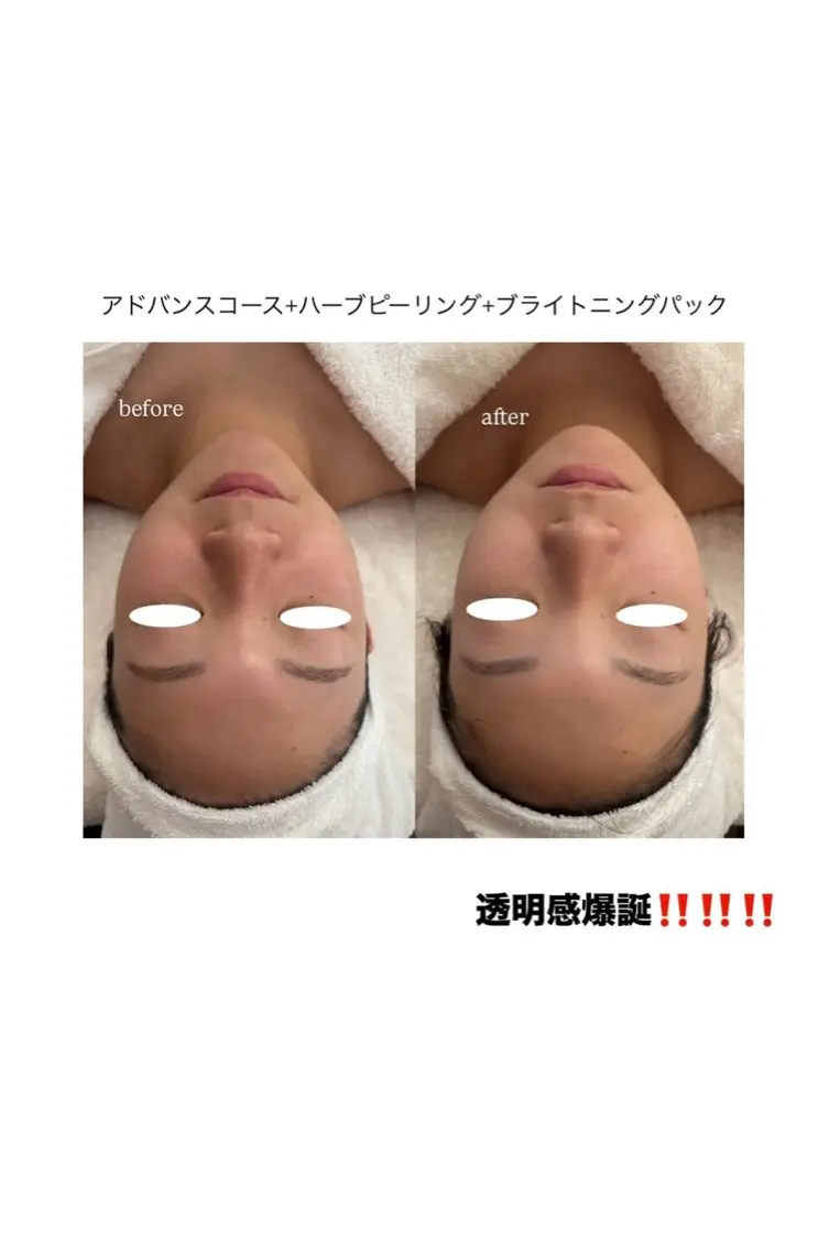 エステ メナード MIYUのその他イメージ