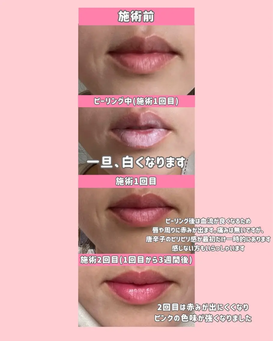 エステ 育乳専門/ピンク トーン/コルギ/脱毛のエステ・リラクイメージ