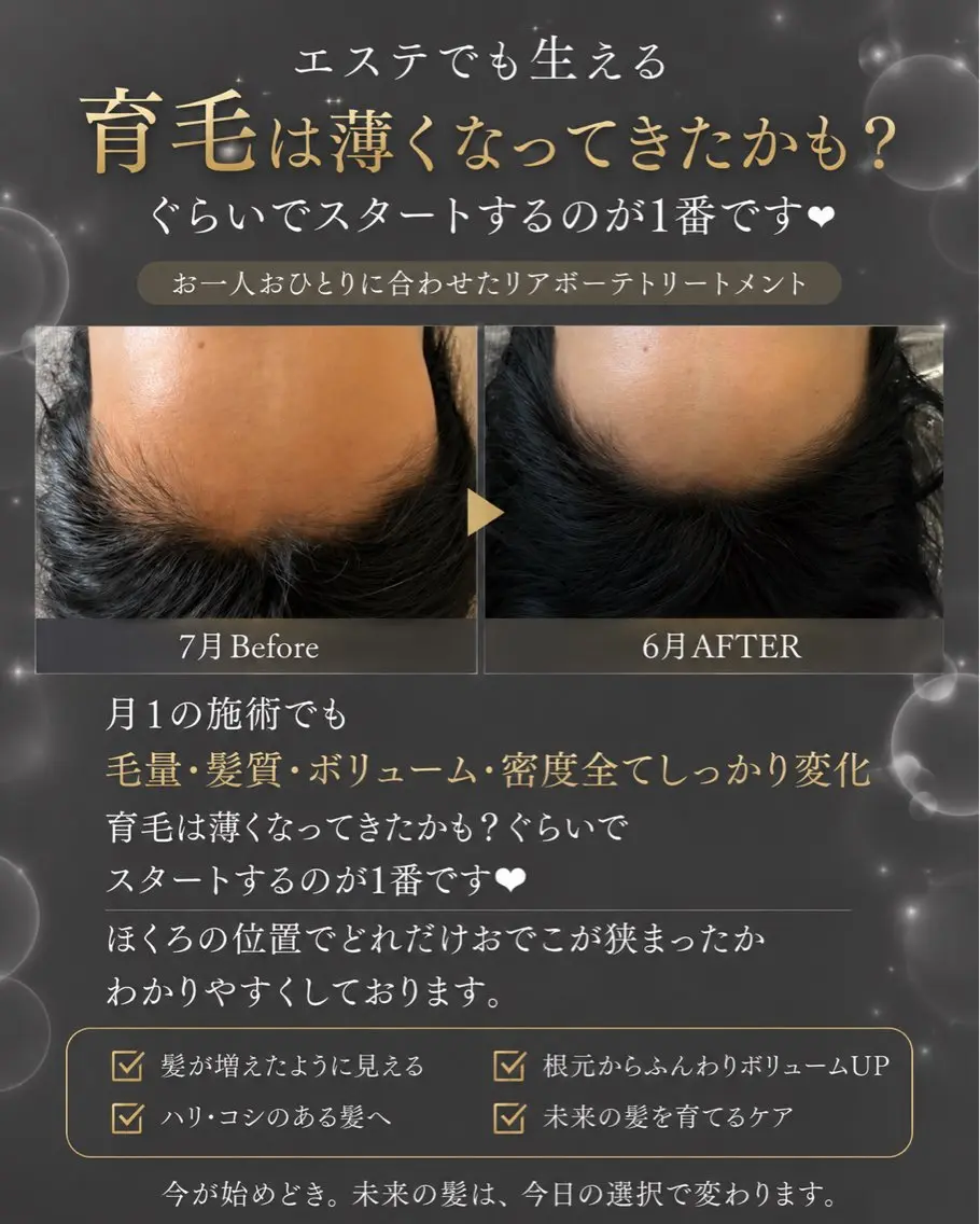育毛スカルプジェットトリートメント【薄毛・白髪・養毛】の写真