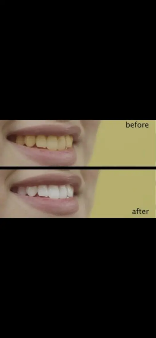 WHITENING ハウスのマツエク・マツパデザイン