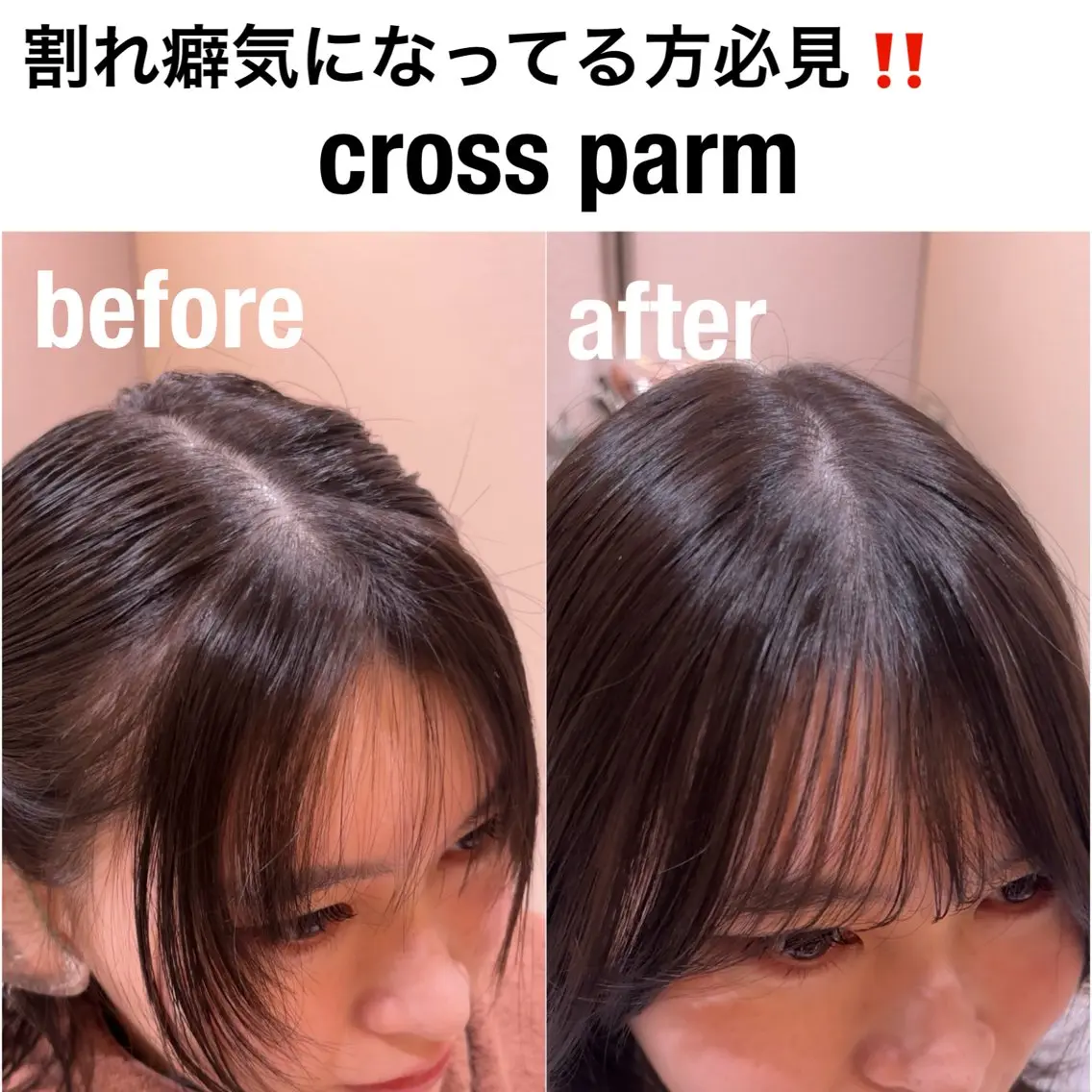 🚨期間限定クーポン🚨を【前髪の割れ癖気になる方必見✨】 クロスパーマ 前髪縮毛矯正🫧の写真