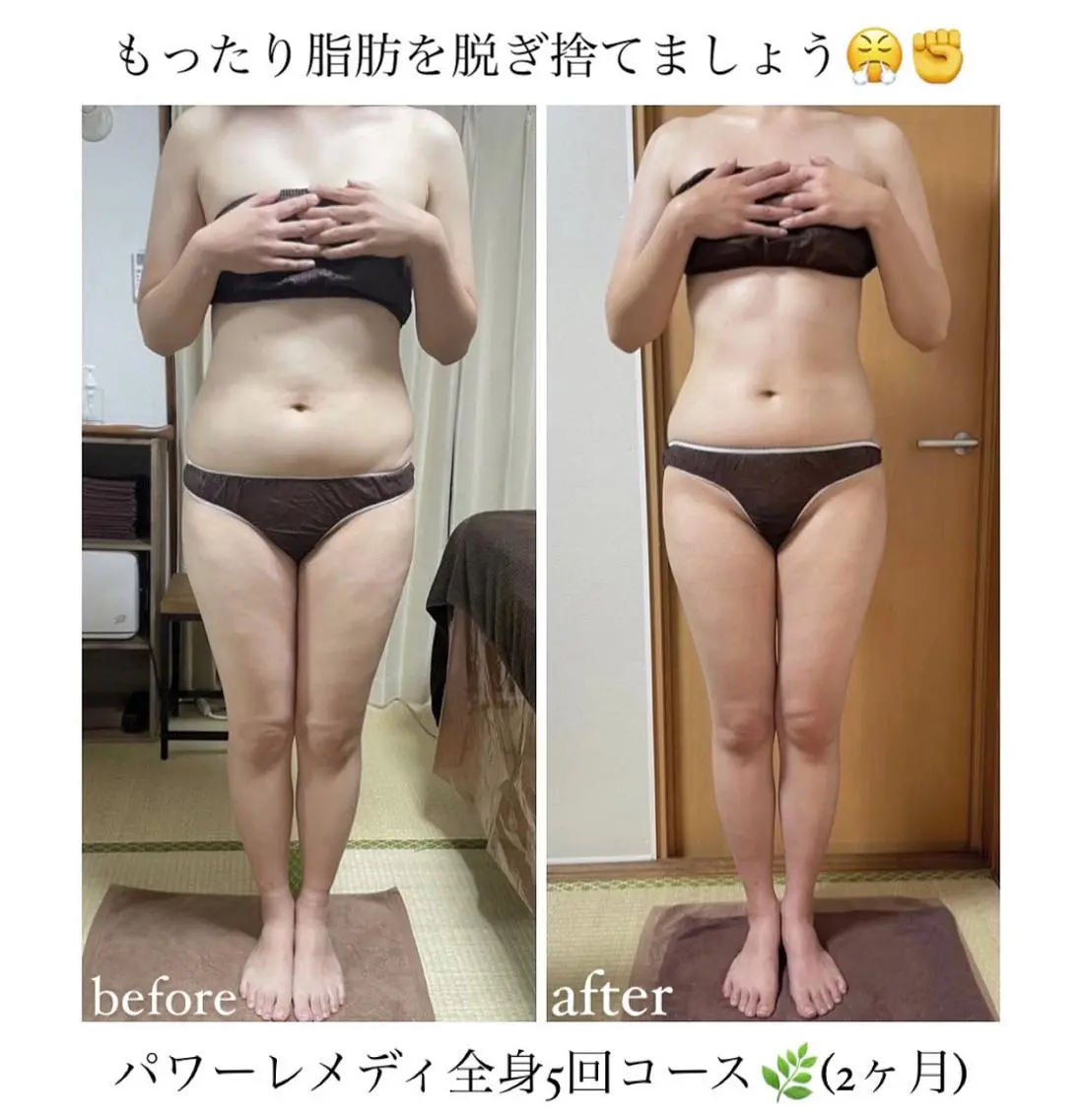 《本気痩せ×疲労改善 》  BILOOPのエステ・リラクイメージ