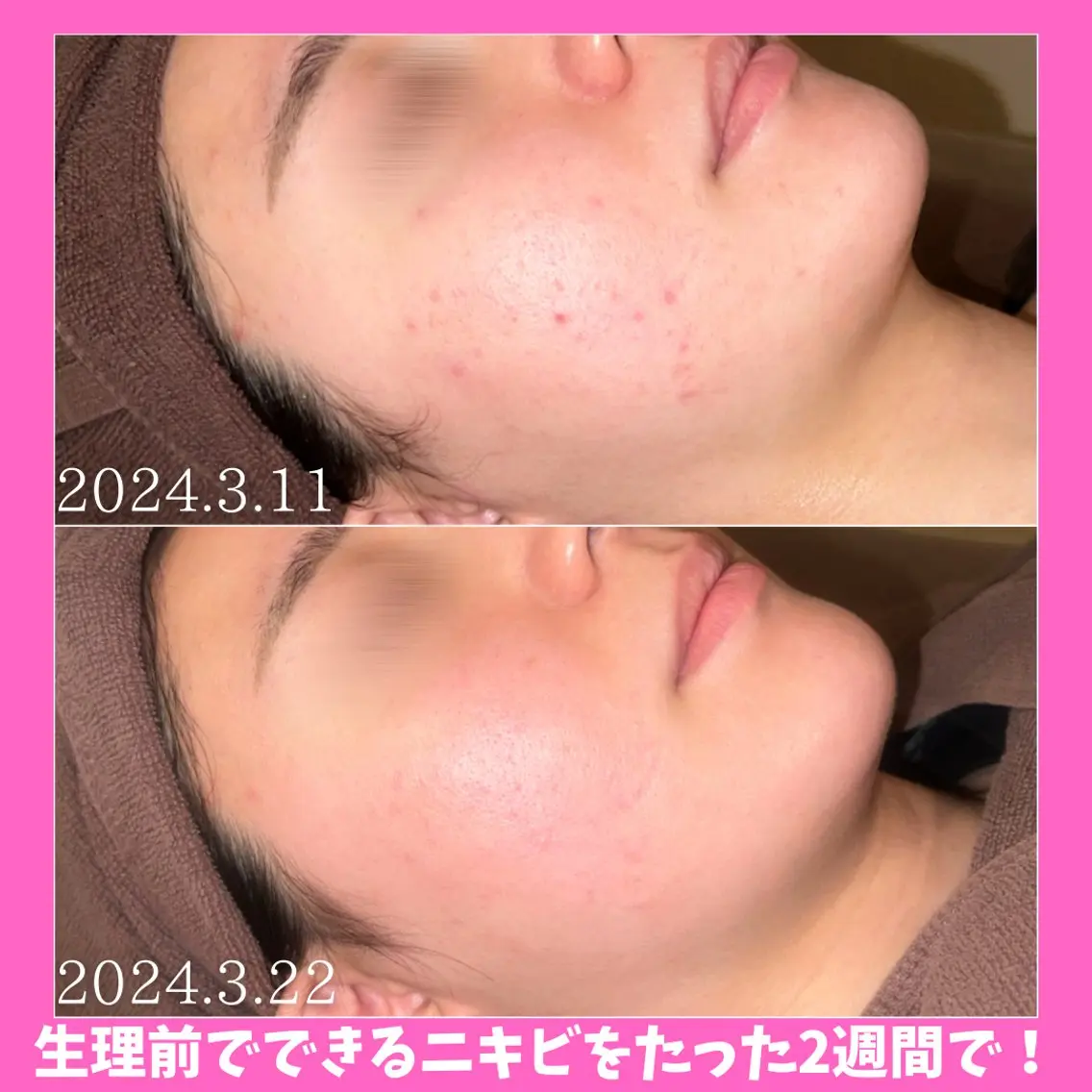 痩身&美肌サロン 堀米✨のその他イメージ