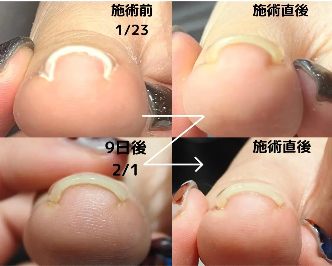 ネイル フットネイル Gatto(ガット) ヤマモトのネイルデザイン