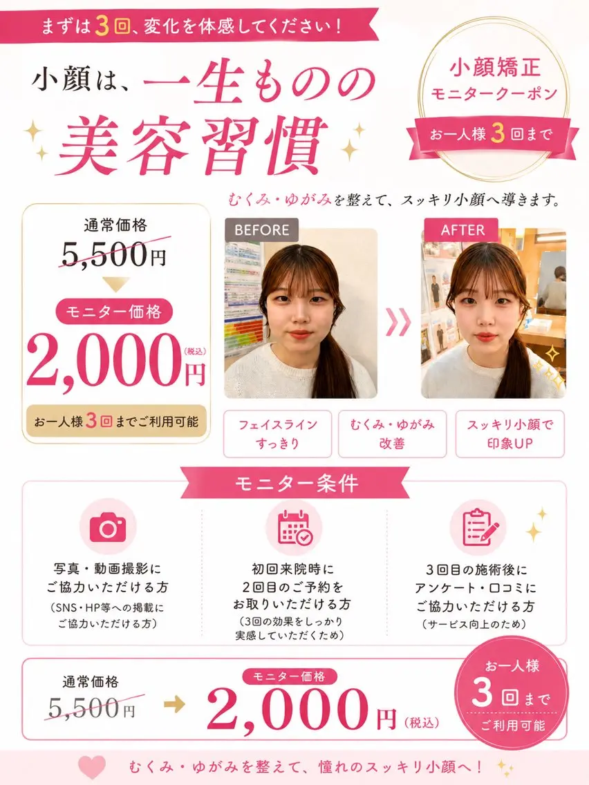 ✨️💆♀️小顔矯正モニター募集💆♀️✨️通常6,000円 → モニター価格2,000円【3回まで利用可能】の写真