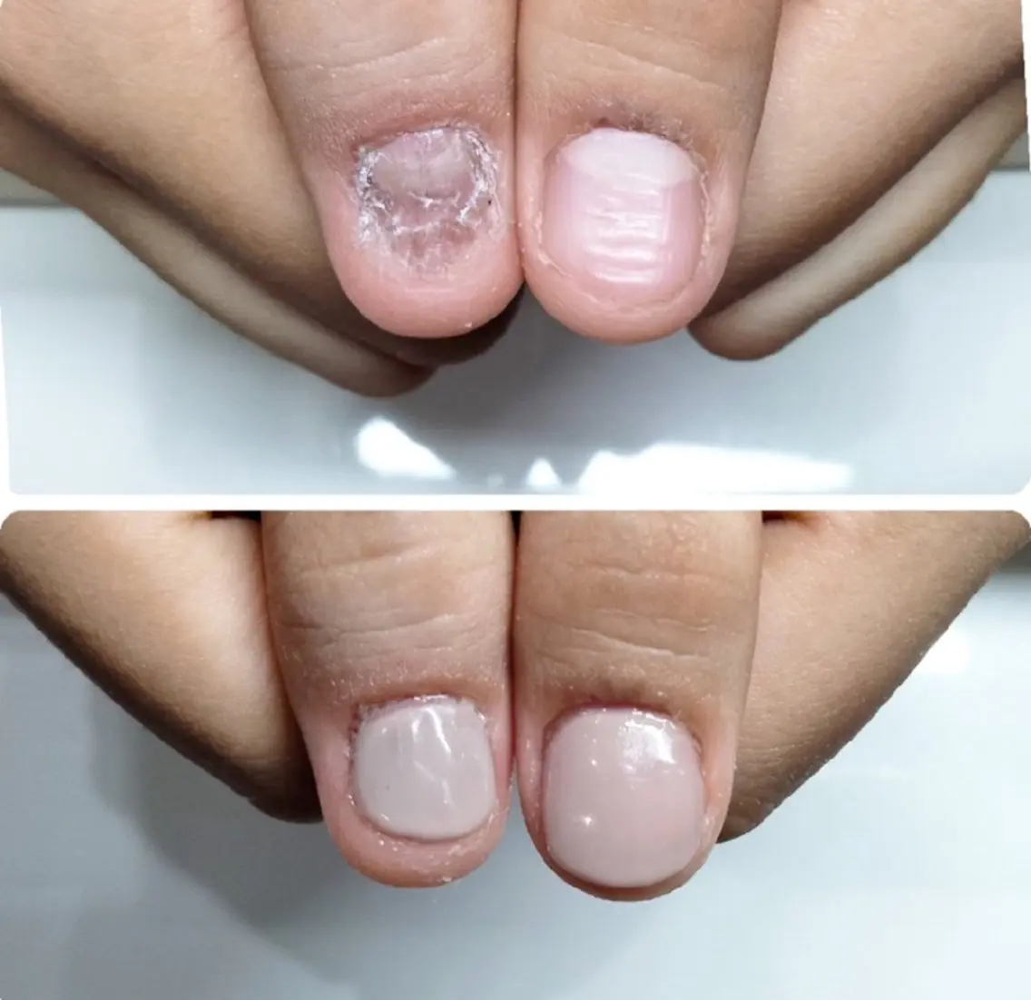 ネイル ネイルサロン アリュームのネイルデザイン