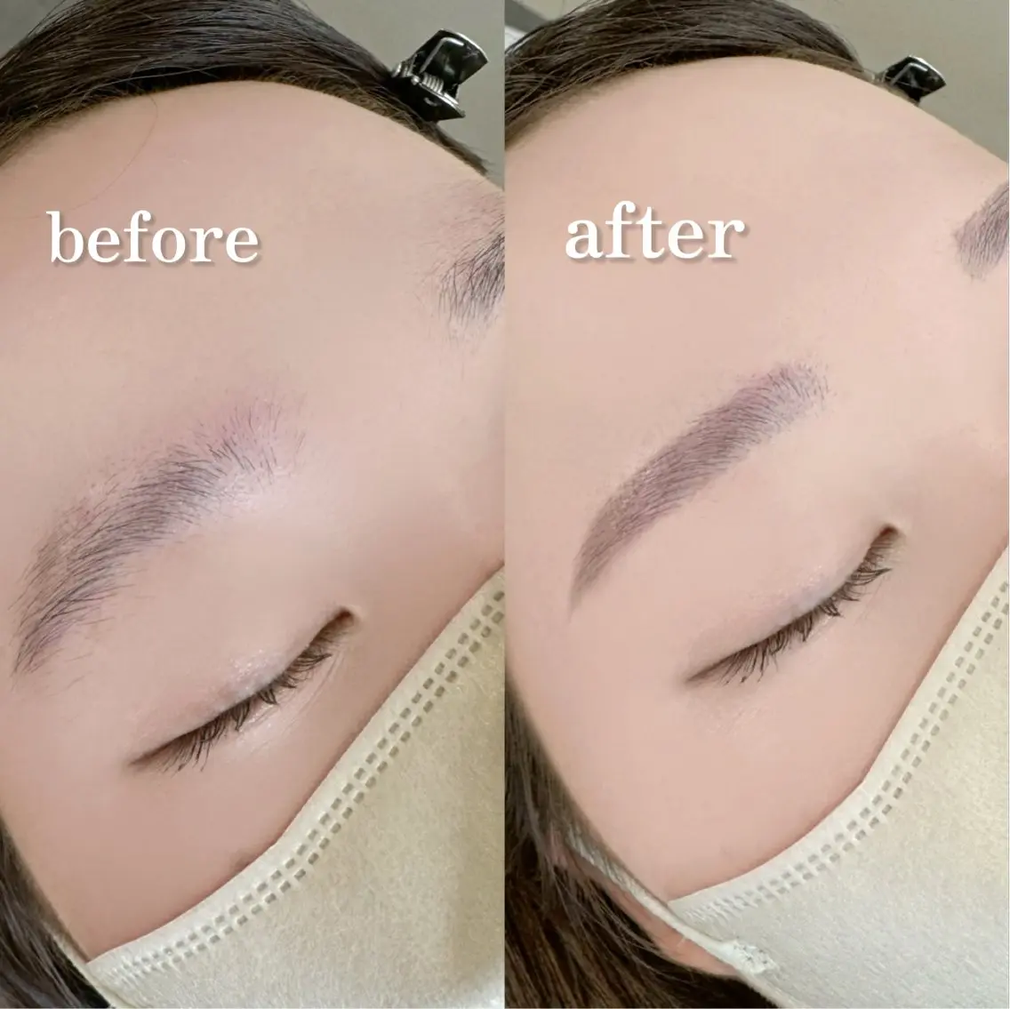 眉ワックス脱毛の写真