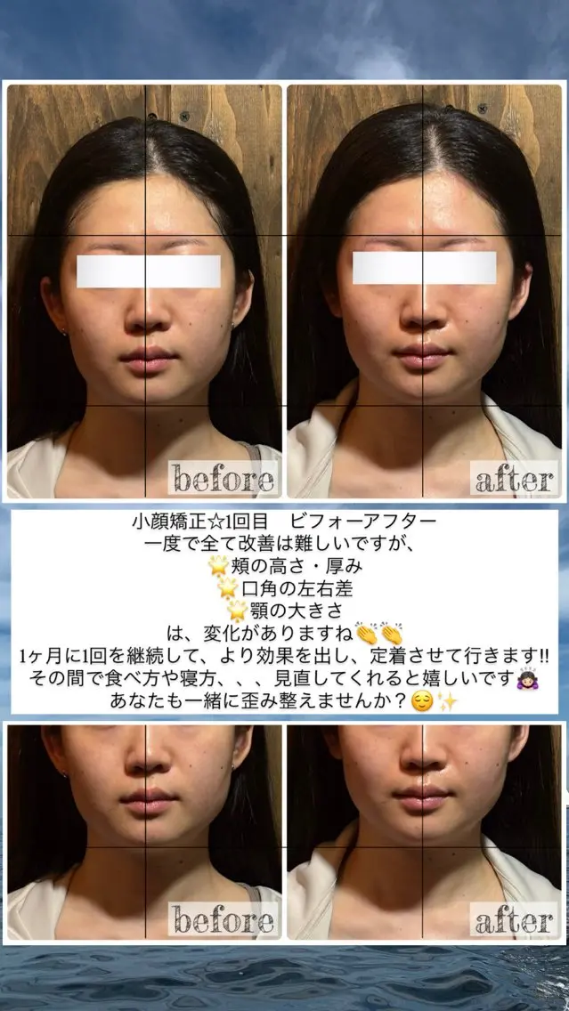エステ リラク 💎後悔させない小顔 矯正💎イトヤマ🌱のエステ・リラクイメージ