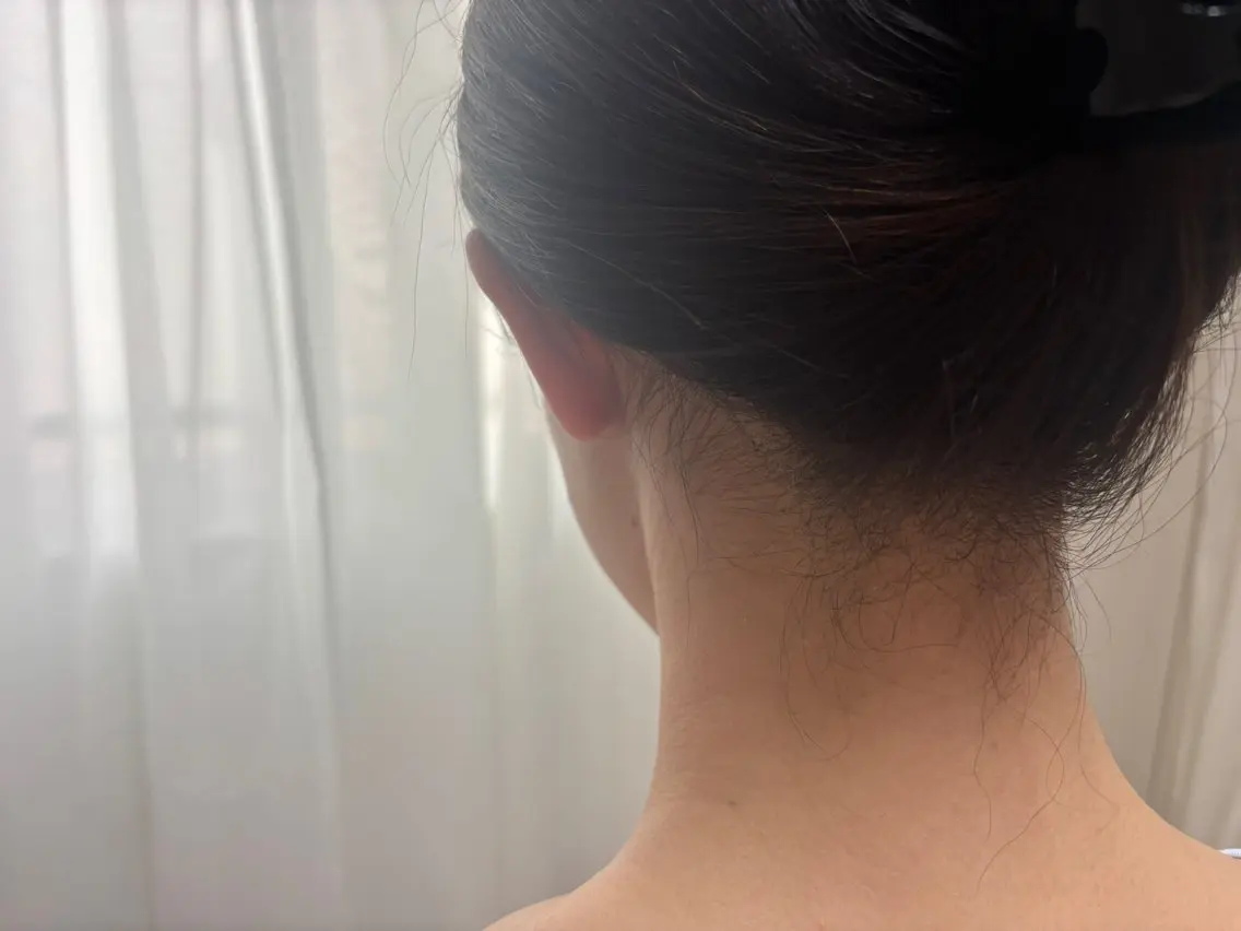 【魅せる夏★オンナを作り上げるスペシャルコース】VIO脱毛➕夏のキャンペーンが一緒に受けられるコースの写真
