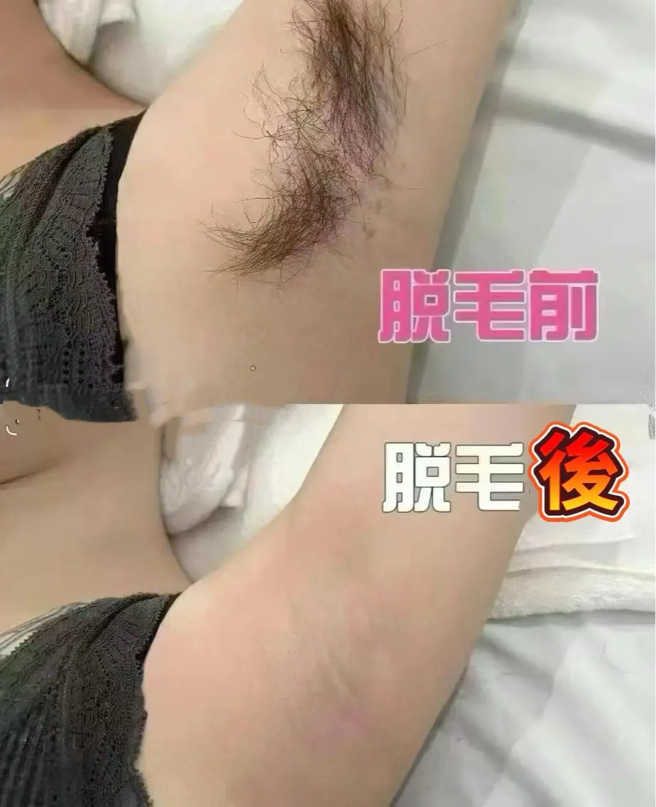 脱毛 上福岡 らんらんのエステ・リラクイメージ