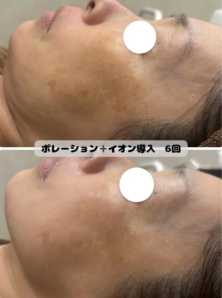 菊地 そらのエステ・リラクイメージ