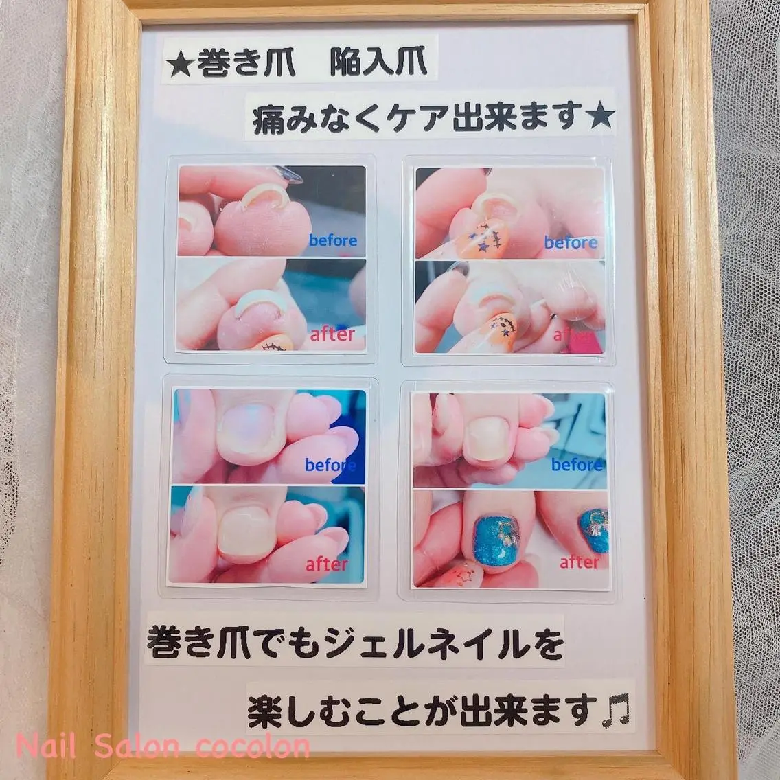 ネイル その他(ネイル) 柴崎 美幸のネイルデザイン
