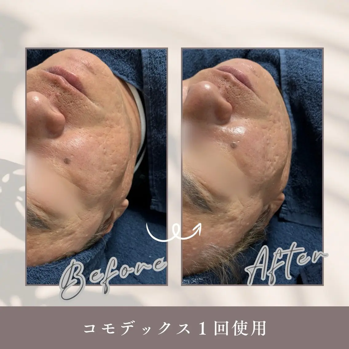 エステ Amor 渡邉のエステ・リラクイメージ
