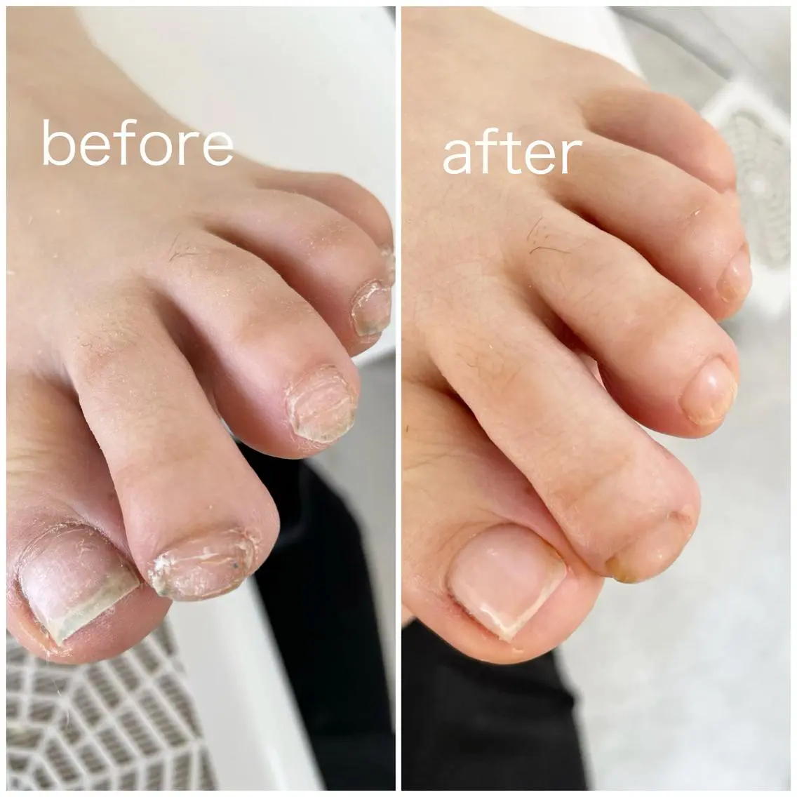 ネイル フットネイル NailLaLuce ネイルラルーチェのネイルデザイン