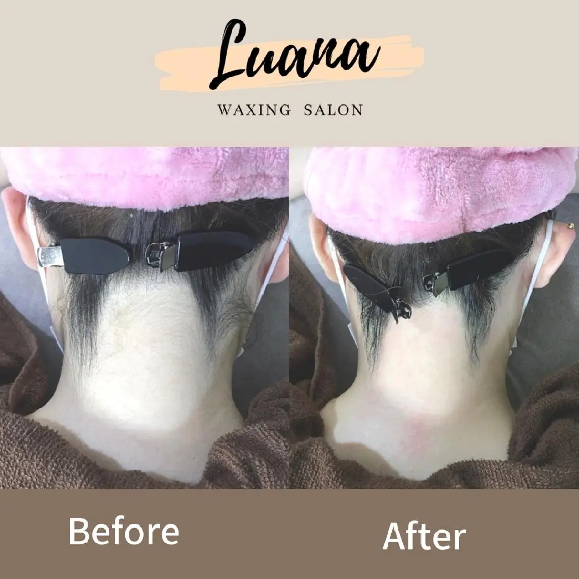 脱毛 Luana wax 🐚根本のエステ・リラクイメージ