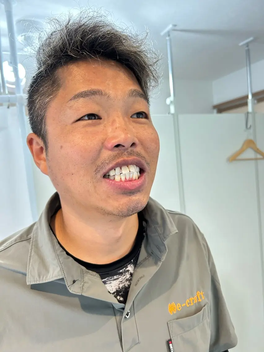 東区香椎歯のセルフホ ワイトニングGLOWのその他イメージ