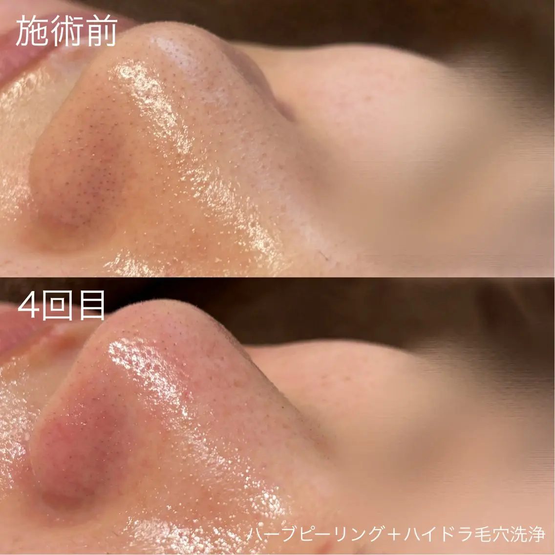 脱毛 lulula ricoのエステ・リラクイメージ