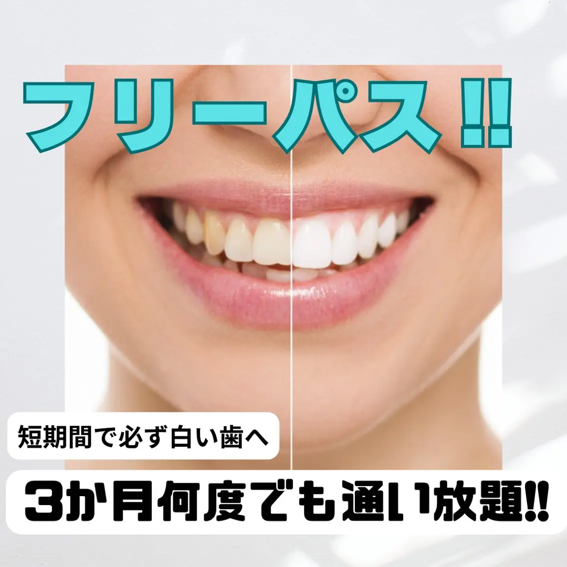 【期間限定!!3か月で必ず白い歯に!!】何回でも通い放題のフリーパス¥33000★セルフホワイトニング◎※口コミ必須の写真