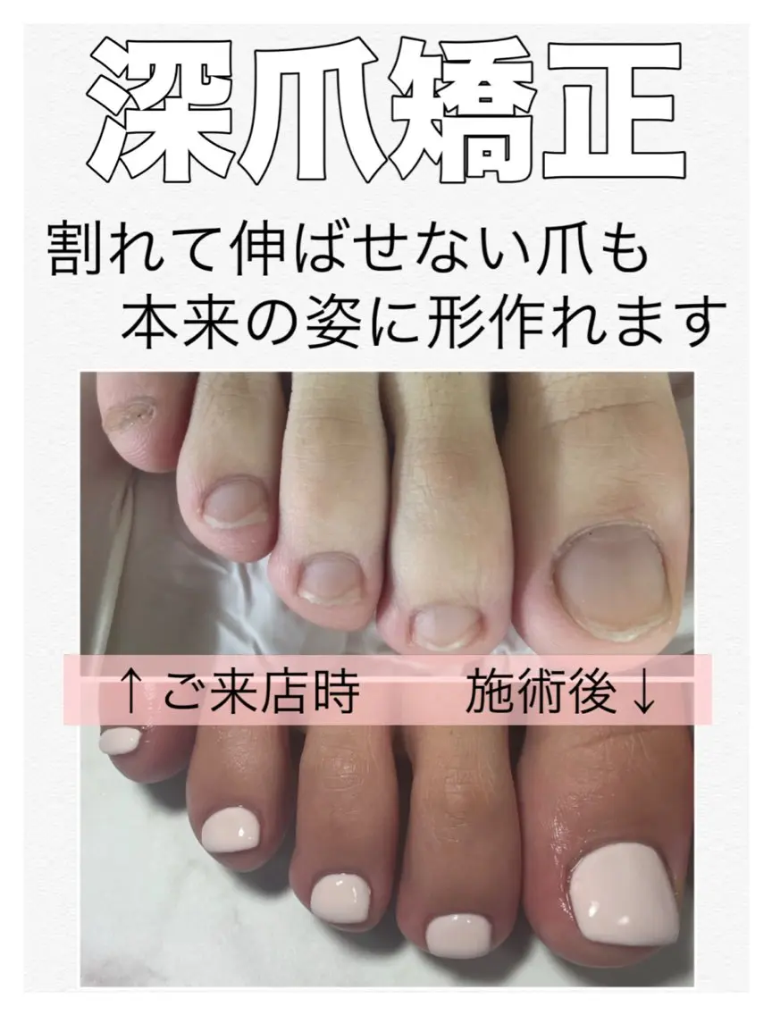 ネイル ラメ(グリッター) おそろいネイル フットネイル nail salon petillantのネイルデザイン