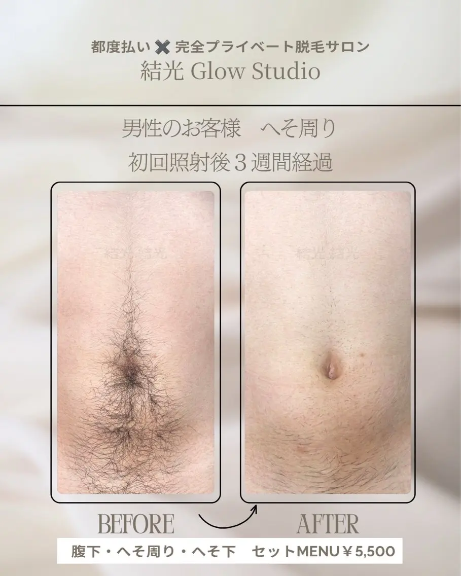 脱毛 結光Glow Studioのエステ・リラクイメージ