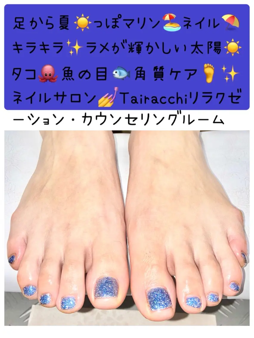 ネイル キラキラネイル ラメ(グリッター) フットネイル Tairacchi ﾀｲﾗｯﾁのエステ・リラクイメージ