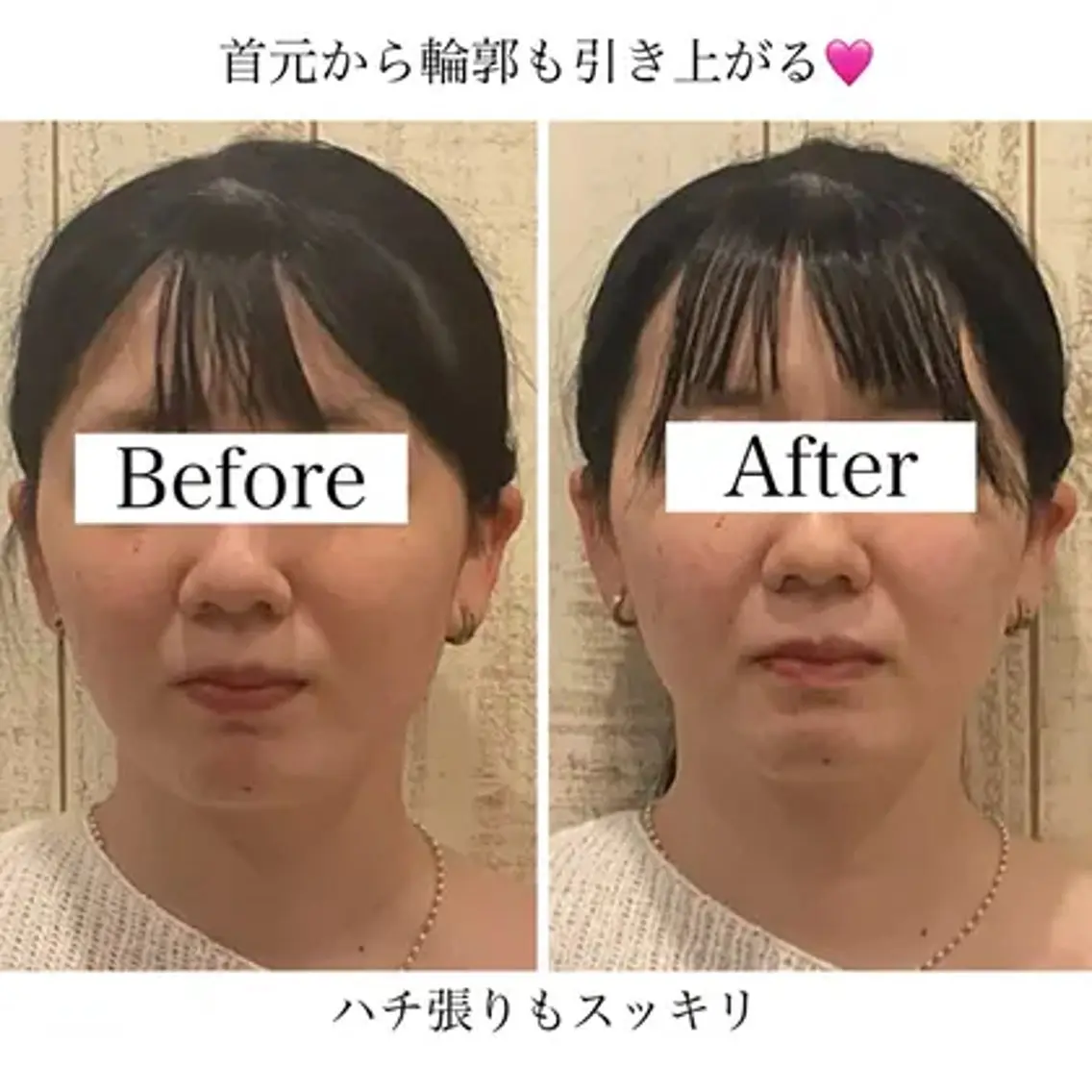 小顔矯正 natsuのエステ・リラクイメージ