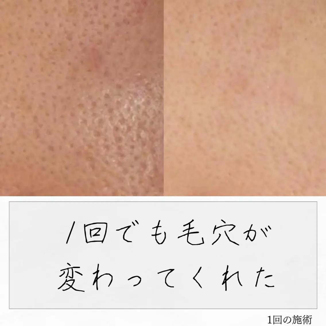 ニキビ経験者が施術 する専門サロン🌻のエステ・リラクイメージ