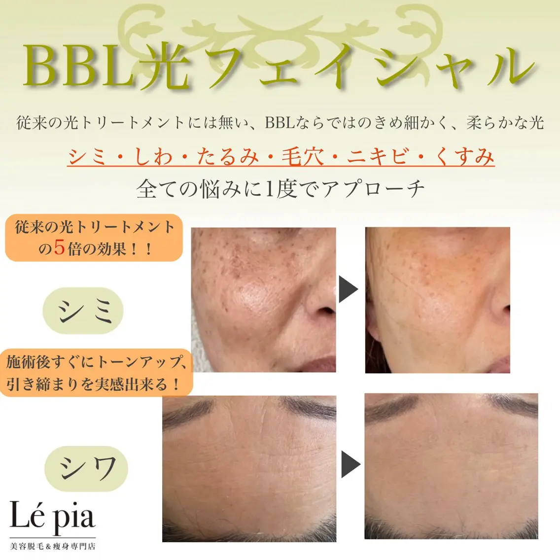 エステ 肌質管理専門店 Lé pia　AMIのエステ・リラクイメージ