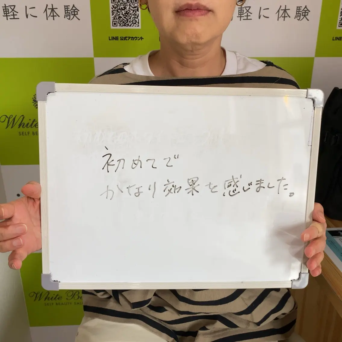 セルフホワイトニング 🦷口元垢抜け✨のその他イメージ