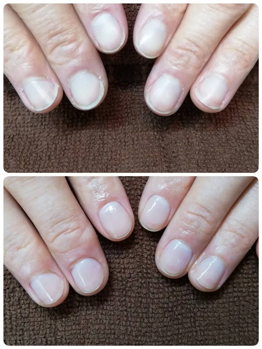 ネイル ジェルネイル オフのみ(ネイル) 深爪矯正/爪育成ケア manie nailのネイルデザイン