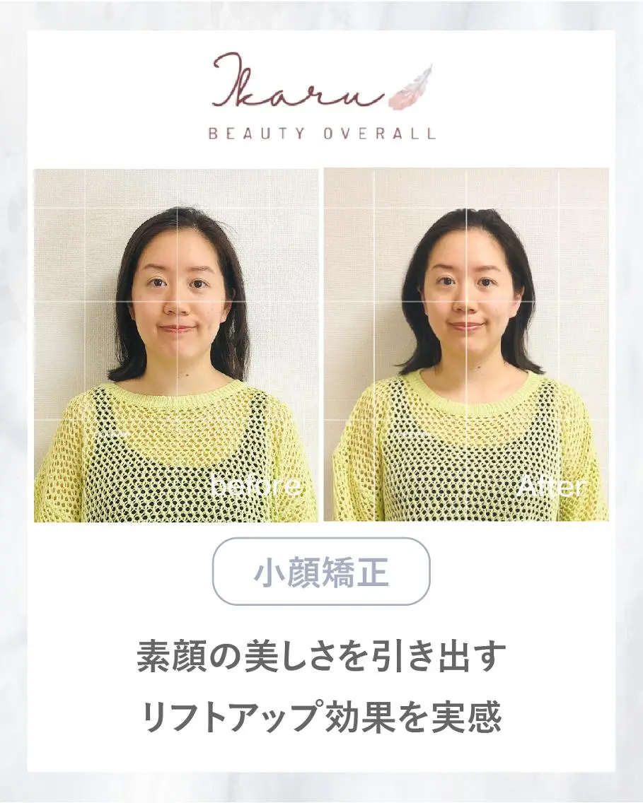 【初回体験】小顔かっさ+小顔矯正+ヘッドスパ+顎関節調整(40分) ¥9000→¥6000の写真