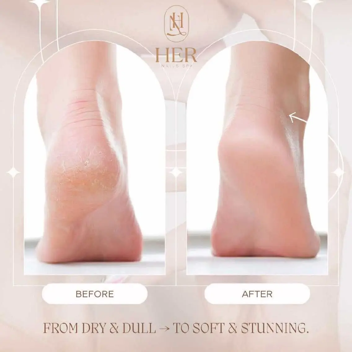 ネイル フットネイル HerNails  Yokosukaのネイルデザイン