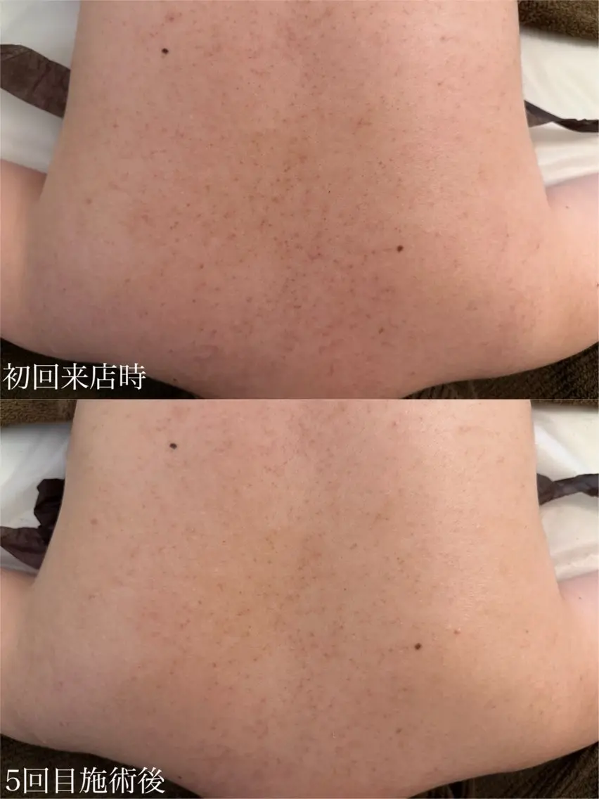 肌管理サロン Briller 押上のエステ・リラクイメージ