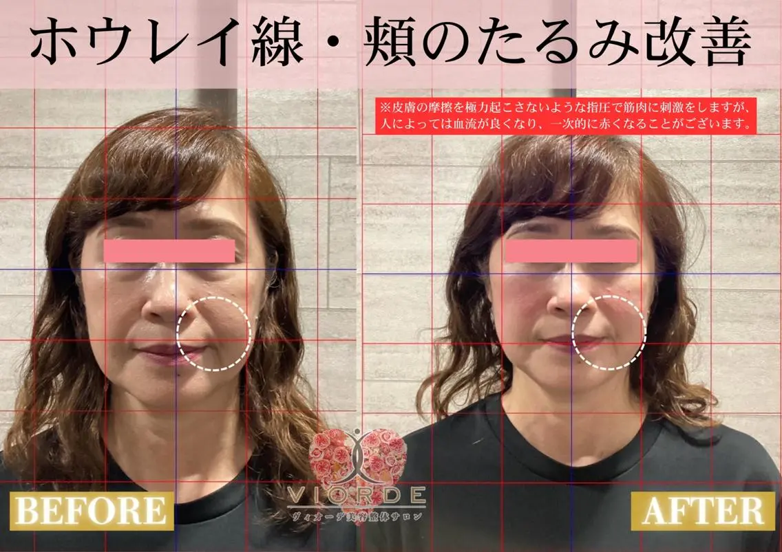 リラク ヴィオーデ美容整体 サロン 大宮店のエステ・リラクイメージ