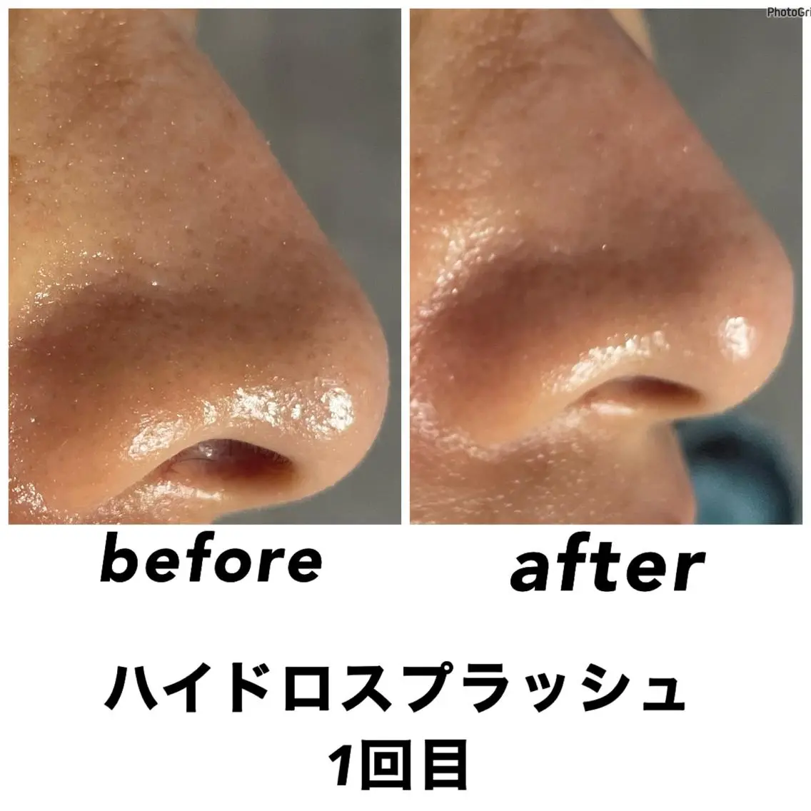 エステ リラク ネイル・エステサロン UILANIのエステ・リラクイメージ