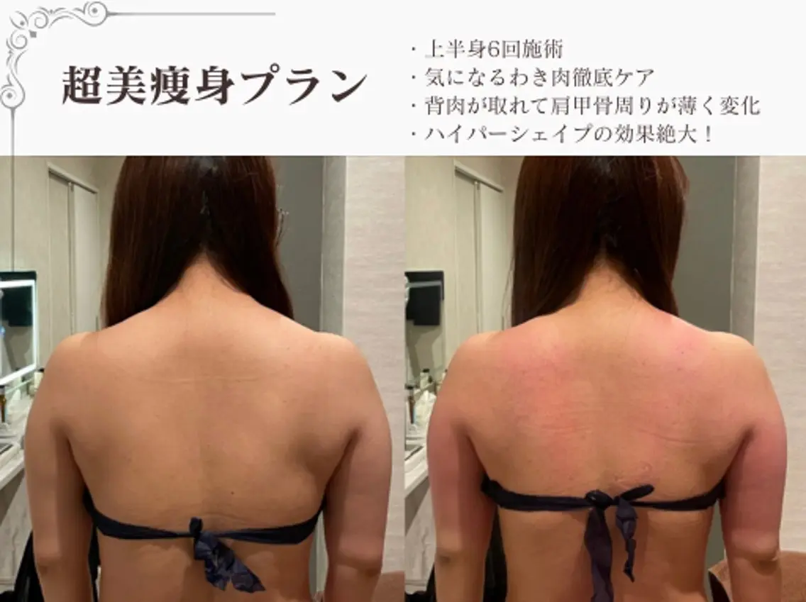 エステ リラク 総合美容サロン LOVEME渋谷本店のエステ・リラクイメージ